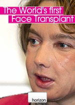 worldsfirstfacetransplant
